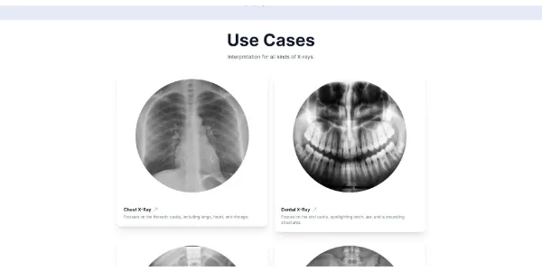 x ray interpreter ai powered x ray interpretation e41795cfdaa7